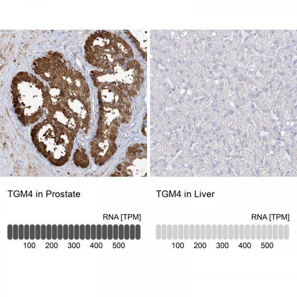 Anti-TGM4