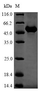 Vitamin D-binding protein (Gc), mouse, recombinant