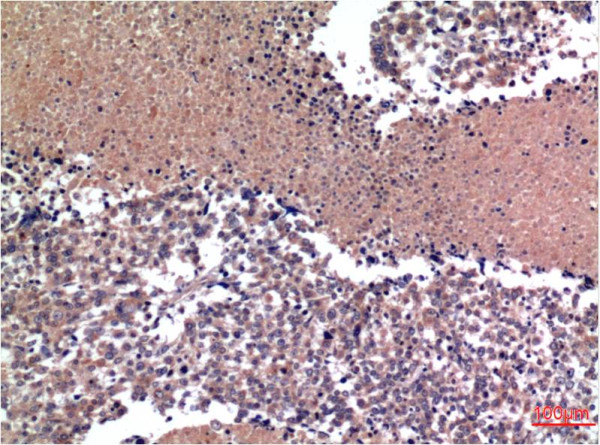 Anti-CCNB1