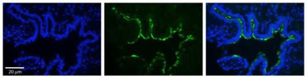 Anti-RAB1A
