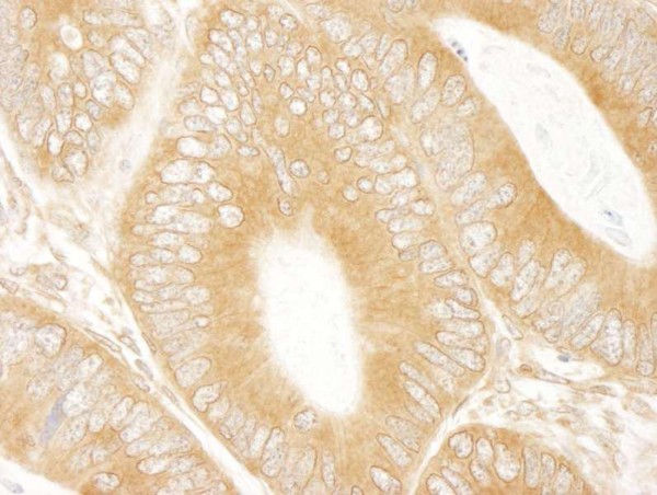 Anti-ABC50 (IHC)