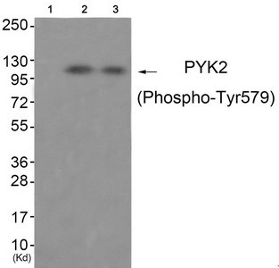 Anti-Phospho-PTK2B (Tyr579)
