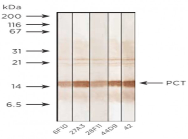 Anti-Procalcitonin, clone 44D9