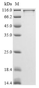 Striatin-3 (STRN3), human, recombinant