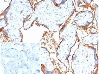 Anti-Nectin-4 / PVRL4, clone NECT4/7271