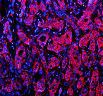 Anti-NID1 / Nidogen 1 / Entactin