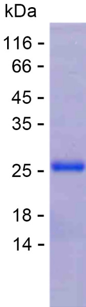 Recombinant Human Retinoic Acid Receptor beta Protein
