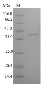Insulin-like growth factor-binding protein 1 (Igfbp1), rat, recombinant