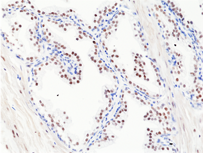 Anti-AR (C-terminal) (human), Rabbit Monoclonal (RM255)