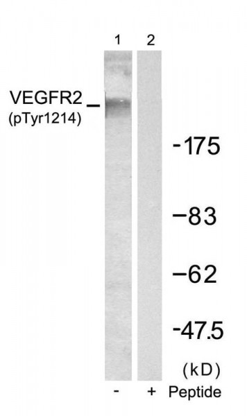 Anti-phospho-VEGFR2 (Tyr1214)
