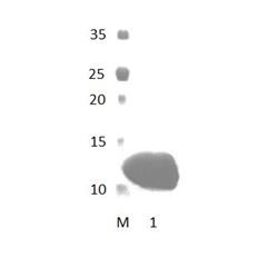 LIN7B PDZ Domain