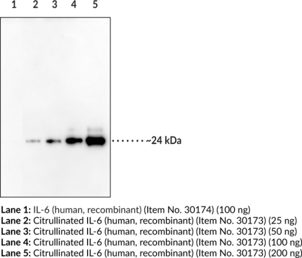 Anti-citrullinated-Interleukin-6