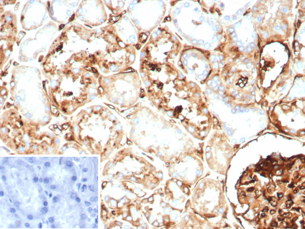 Anti-Beta-2 Microglobulin (Renal Failure &amp; Tumor Marker), clone BBM.1