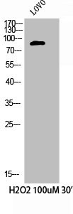 Anti-Phospho-CTTN (Y421)