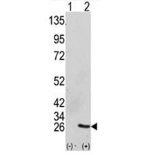 Anti-GRB2
