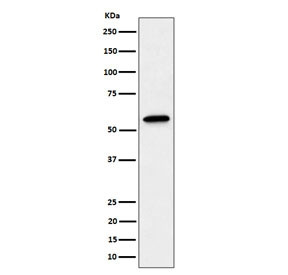 Anti-SF3A3 / Splicing factor 3A subunit 3 / SF3a60, clone 29S29
