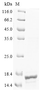 CD81 antigen (CD81), partial, human, recombinant