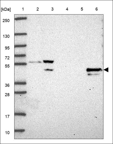 Anti-RBBP7