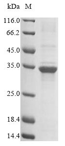 Troponin I, slow skeletal muscle (Tnni1), mouse, recombinant