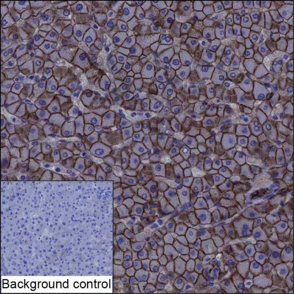 Anti-CDH1 Recombinant