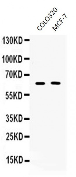 Anti-TUB / Tubby protein homolog
