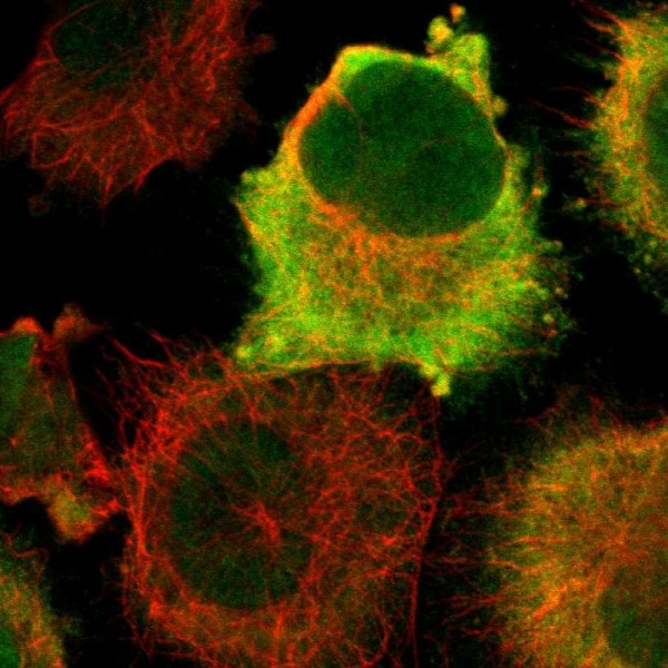 Anti-CDK1