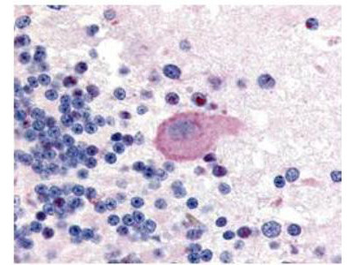 Anti-phospho-Huntington Protein (Ser421) (Huntington Disease)