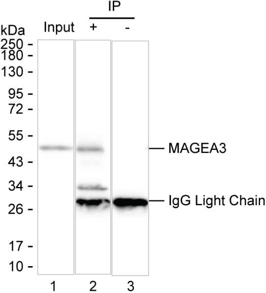 Anti-MAGEA3 Magnetic Beads