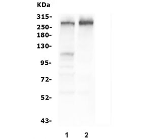 Anti-TSC2 / Tuberin, clone 6I3