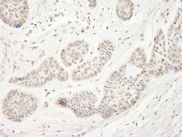 Anti-NP95/UHRF1 (IHC)