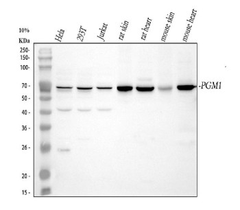 Anti-PGM1 / Phosphoglucomutase 1