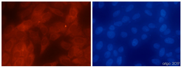 Anti-Erk1/2, clone B20-U