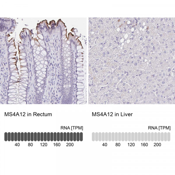 Anti-MS4A12