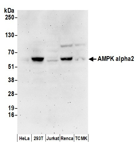 Anti-AMPK alpha 2