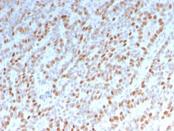 Anti-Estrogen Receptor alpha, clone ESR1/3342