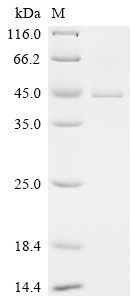 Ubiquitin-conjugating enzyme E2 J1 (UBE2J1), partial, human, recombinant