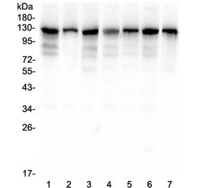 Anti-DOG-1 / TMEM16A / ANO1