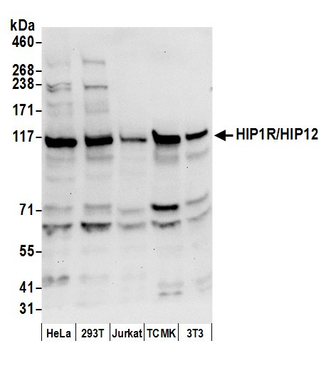 Anti-HIP1R/HIP12