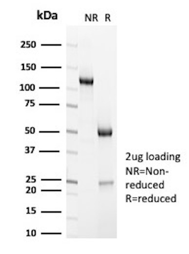 Anti-CD7 (T-Cell Leukemia Marker), clone HuLy-m2