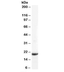 Anti-GPX4 (isoforms a and c)