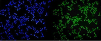 Anti-MCPIP1 / ZC3H12A