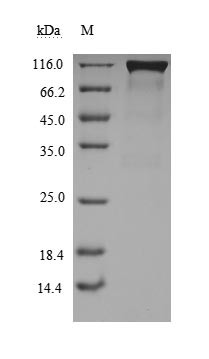 Angiotensin-converting enzyme 2 (ACE2), partial (Active), Paguma larvata, recombinant
