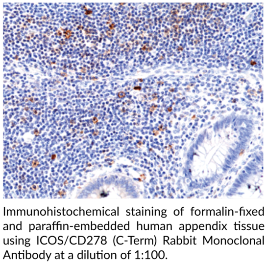 Anti-ICOS/CD278 (C-Term) Rabbit Monoclonal Antibody (RM417)