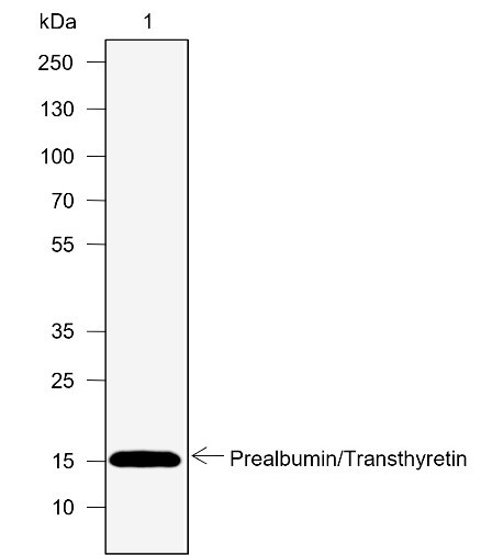 Anti-Recombinant Prealbumin/Transthyretin, clone A768