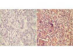 Anti-Wnt5A