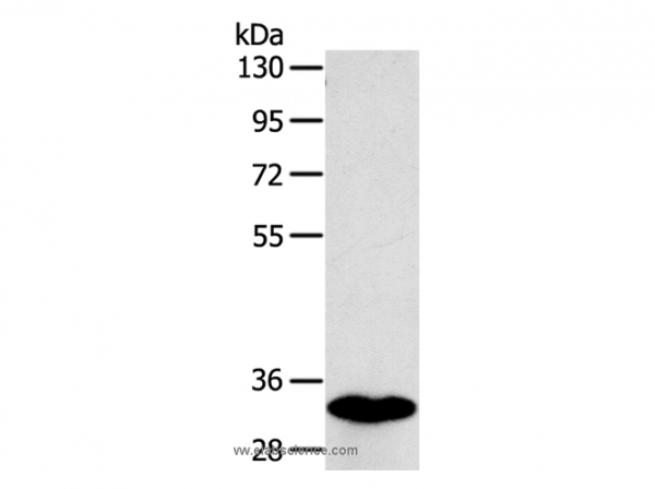 Anti-SULT1B1