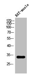 Anti-Phospho-PPP1R1B (T34)