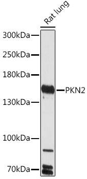 Anti-PRK2/PKN2