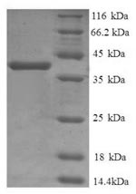 Cathepsin D (CTSD), partial, human, recombinant