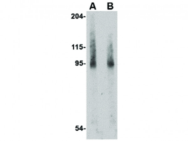Anti-BICD2